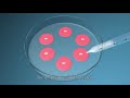 IVF &amp; Multiple Pregnancies I Dr.RadhikaMeka I Parampara Fertility Centre