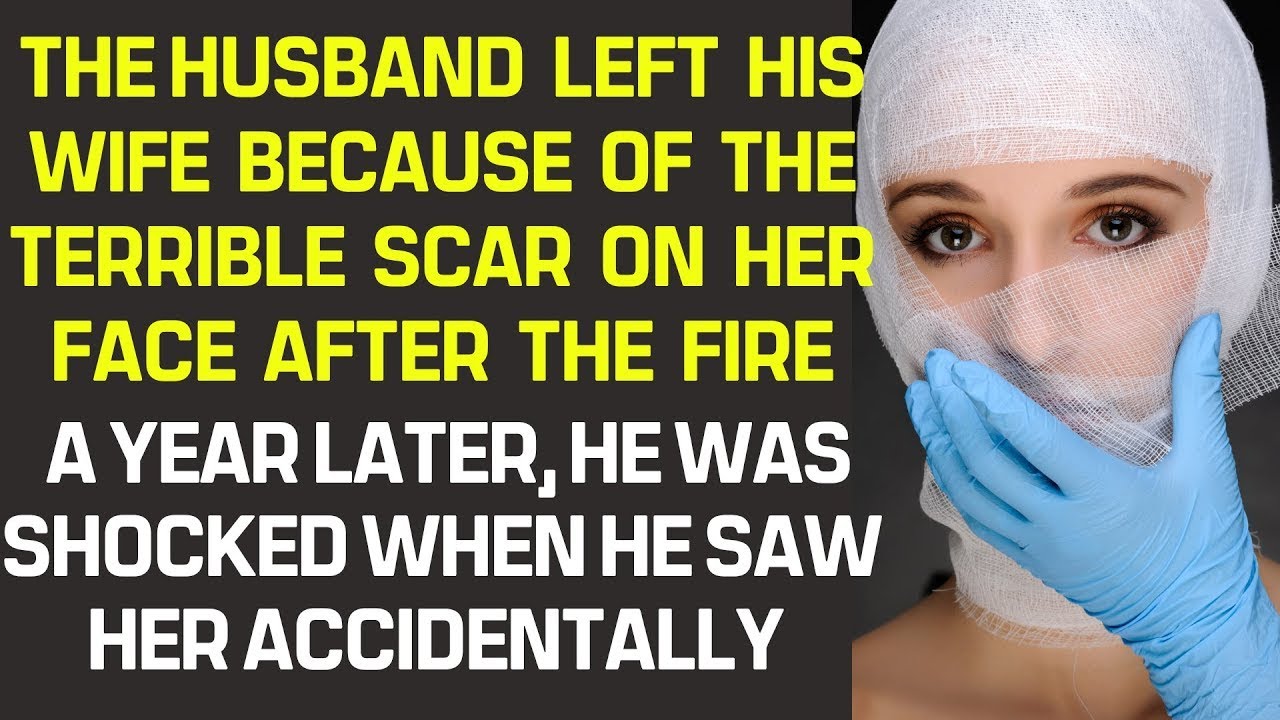 The husband left his wife because of the terrible scar on her face ...