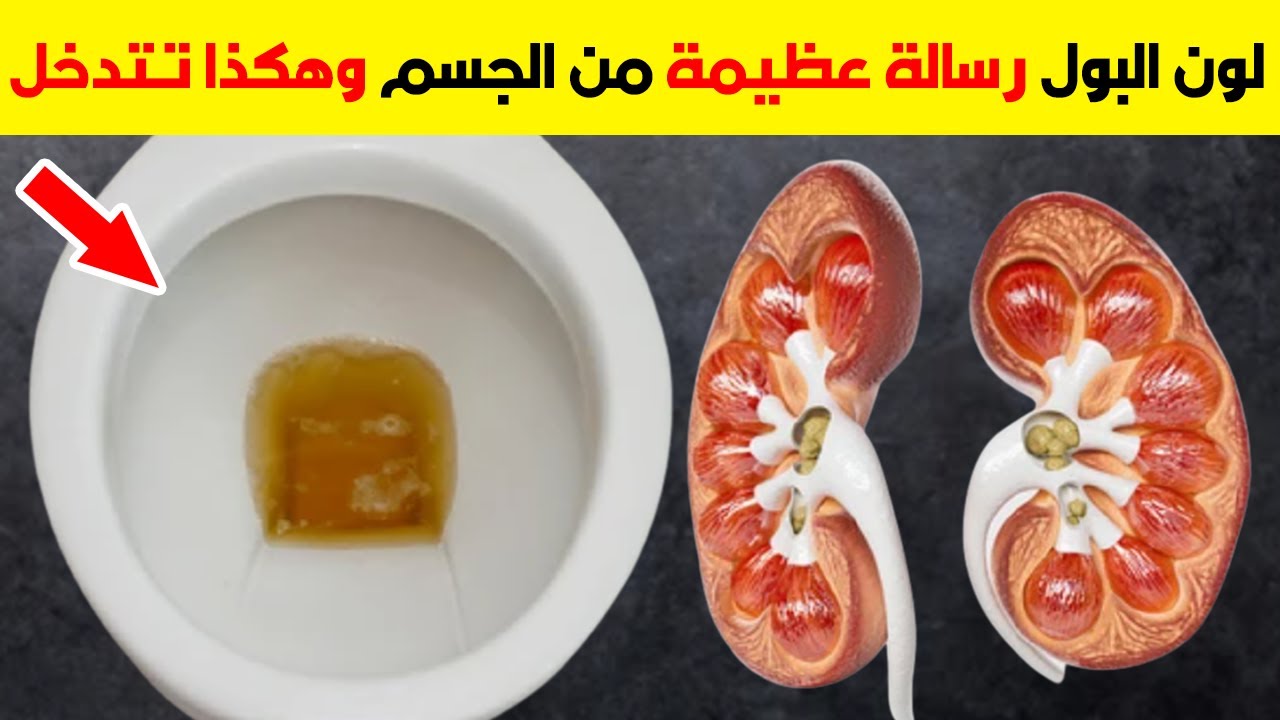 ماذا يخبرك لون البول عن جسمك يمكنك أن تسيطر على التهاب الكبد وحصى الكلى ...
