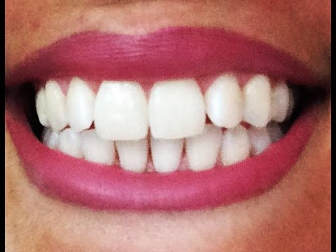Dents blanches, comment fabriquer son dentifrice bio en 1 min ! Sans FLUOR, sans produits CHIMIQUES