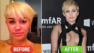 CELEBRITY BEFORE AND AFTER PLASTIC SUERGERY | Miley Cyrus |