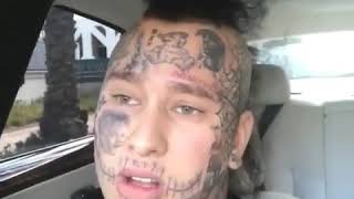 Stitches talks about xxxtenacion