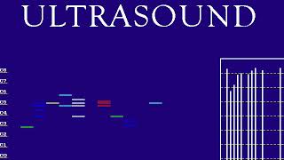 Gravis Ultrasound - Pro Patches Lite - SMARTINO.MID