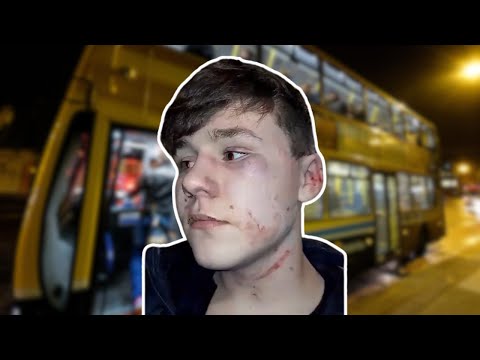 Diversity is our Strength! Irish Boy Almost beaten to Death! Reaction!