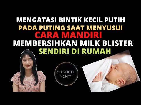 Mengatasi Bintik Putih Kecil Pada Puting | Cara Mengatasi Milk Blister | Membersihkan Milk Blister