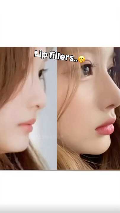K-pop idols’ surgery that was worth it…?! #kpop #nmixx #babymonster #blackpink #viral #youtubeshorts