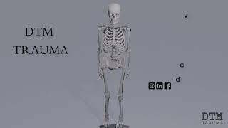 DTM Orthopedic Plates