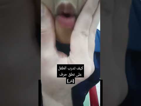 كيف تدرب الطفل على نطق حرف ش ارطوفونيا علاج النطق عيادة بلبشير تأخر النطق Orthophonie 