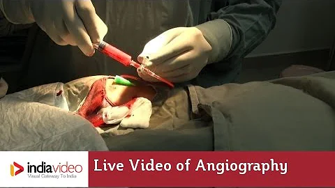 Live Video of Angiography at Lisie Hospital | How angiography is done