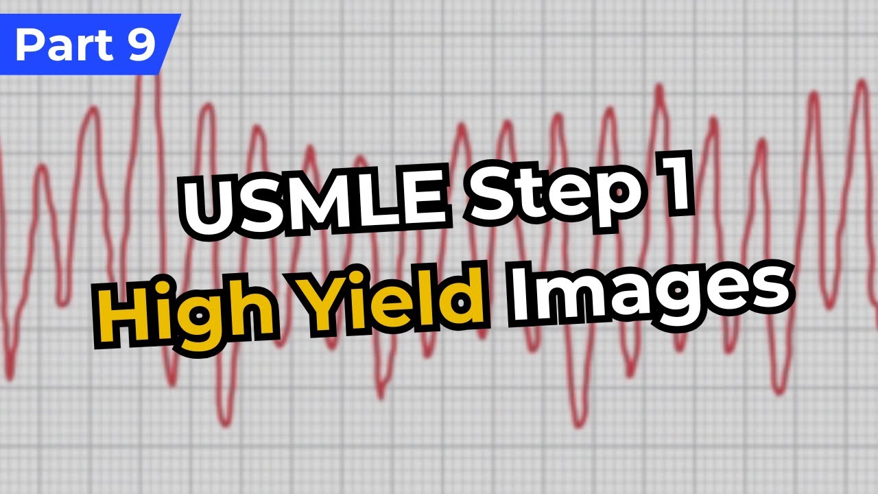 USMLE Step 1 High Yield Images (Part 9) - YouTube
