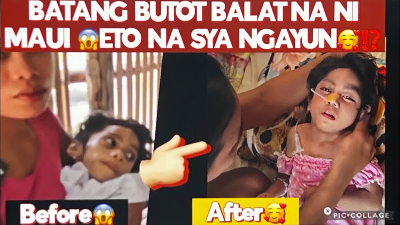 BUTOT BALAT NUON ETO NA SYA NGAYUN⁉️
