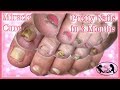 👣Pedicure Tutorial Miracle Cure for Pretty Healthy Toenails 👣