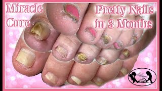 👣Pedicure Tutorial Miracle Cure for Pretty Healthy Toenails 👣