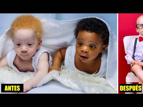 Video: ¿Pueden los gemelos idénticos tener diferentes colores de ojos?