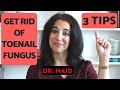 Fungus of the Toenail -- 3 Treatment Tips