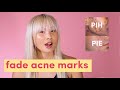 Fade acne marks post inflammatory hyperpigmentation  post inflammatory erythema   pih  pie