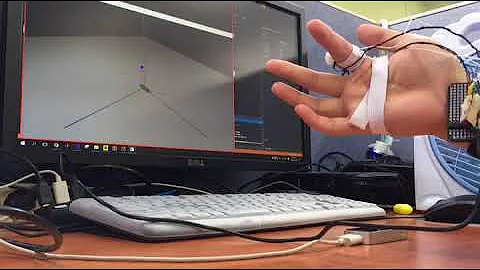 3D position estimation using stereo vision