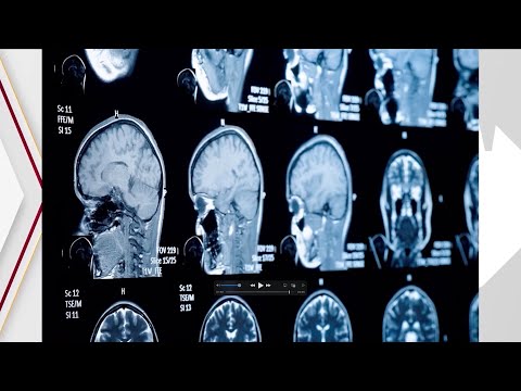 Neuroscience Nurse Practitioner