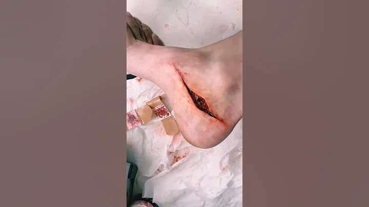 اخطر خدع الجرح sfx makeup cinematic #sfx #sfx_makeup #sfxartist #youtubeshorts #makeup #shorts