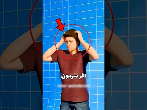 اگر سرمون شوره زد چیکار کنیم دانستنی سرگرمی