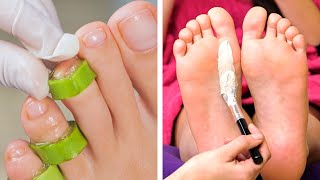 Truques incríveis para cuidar dos pés e truques de pedicure