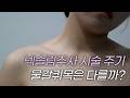 물갈퀴 목인 사람들, 시술 주기가 다르다?