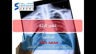 تغبر الرئة pneumoconiosis II