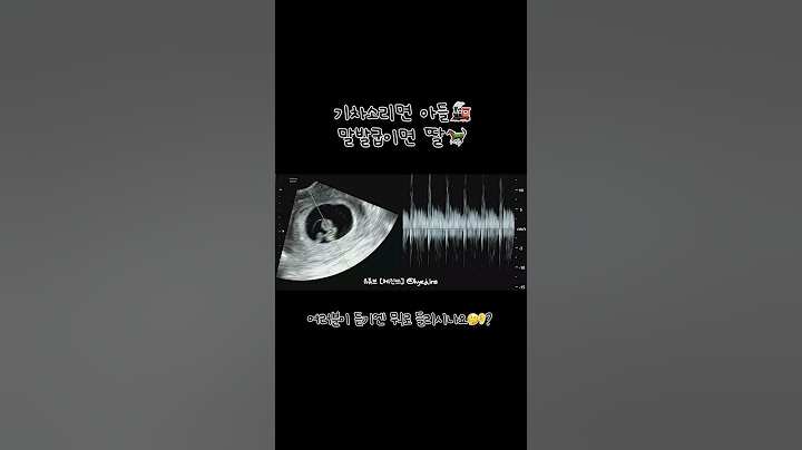 심장소리로 태아 성별 맞추기🤔