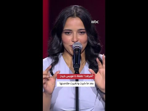 ذا فويس هل تذكرون طفلة ذا فويس كيدز أشرقت صاحبة أغنية أما براوه شاهدوا ملامحها بعدما كبرت