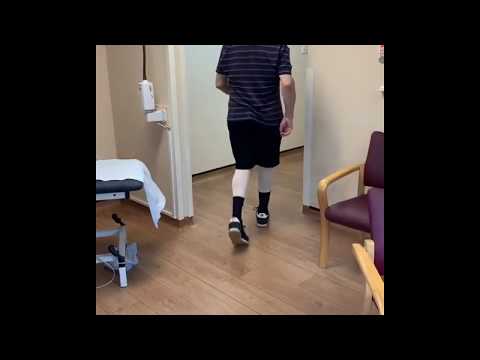 12 Days After Knee Replacement - No Crutches After 7 Days -part 2-