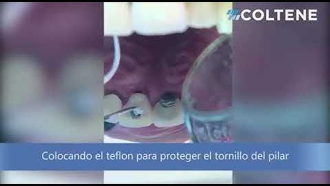 How To Use Coltosol Dentbear.com