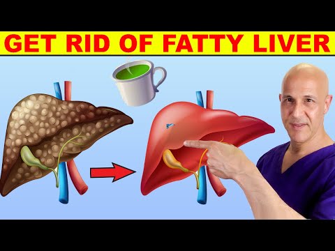 2 Cups a Day...Cleans Up FATTY LIVER | Dr. Mandell