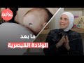 التعافي بعد الولادة القيصرية نصائح عملية لرحلة الشفاء السريعة 