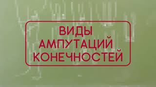 Виды ампутаций конечностей