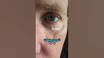 أسباب ارتجاف العين 