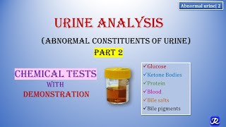 2: Abnormal Urine | Part 2 | Urine Analysis | Chemical Tests | Biochemistry | N'JOY Biochemistry