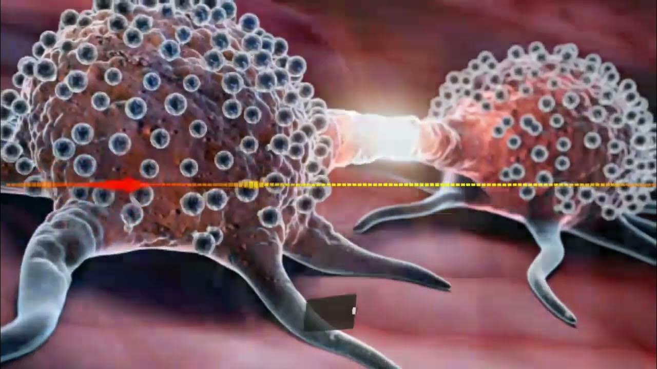 Опухолевые клетки. Инфицирующий рак. Опухолевые клетки. Опухолевые клетки. Онкология иллюстрации.