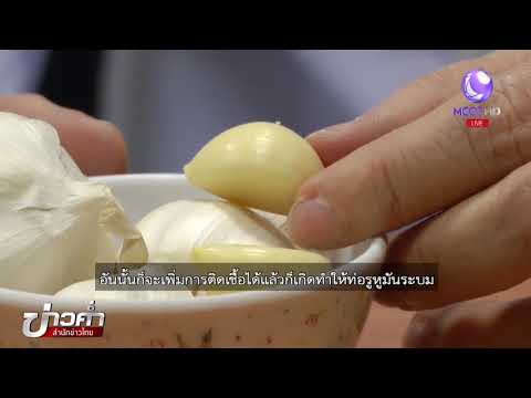 ชัวร์ก่อนแชร์ : กระเทียมใส่หูก่อนนอน แก้ปวดหูจริงหรือ ?