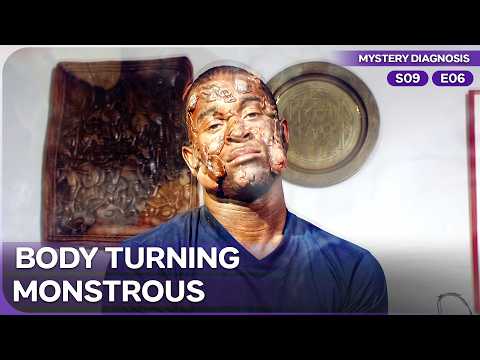 Monstrous Flesh Transformation Invading a Star Athlete | Mystery Diagnosis