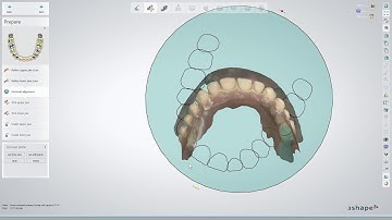 Tutorial - Connect Case Center Inbox to 3Shape: Implant PLY Format