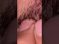 Hair massage hair removal hair beard 🧔 hair style