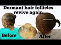 Revive Dormant Hair Follicles Easily! Use it like this