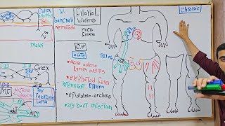filarial worms | W. Bancrofti | B. Malayi | Mansonella | BSU 2026 |1st year Heme module DR Moaz