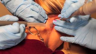 Laser Tattoo Removal at LeBeau Clinic in Pensacola FL