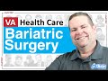 S21:E8 | Bariatric Surgery | Weight Loss Options with Sleeve Gastrectomy or Gastric Bypass