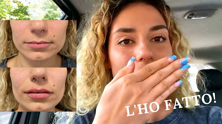 HO FATTO IL FILLER ALLE LABBRA | Vlog 15-09-2021