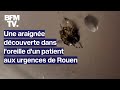 Une araignée retrouvée dans l&#39;oreille d&#39;un patient aux urgences de Rouen