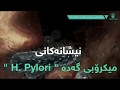 نیشانەکانی میکرۆبی گەدە H Pylori 