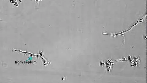 Life Cycle of Cryptococcus neoformans: Supplementa...