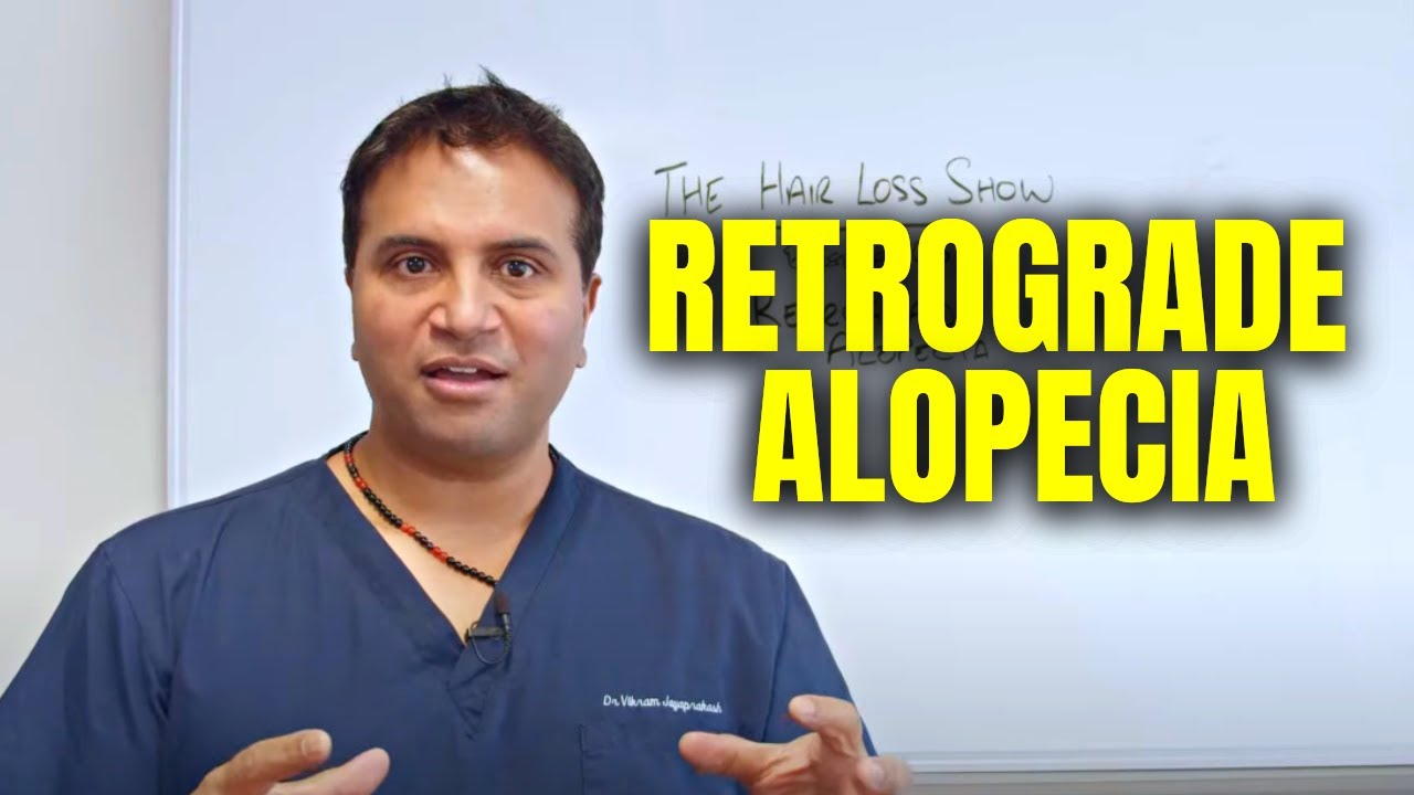 Retrograde Alopecia